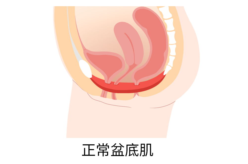 揭秘女性盆底肌的几大作用,内附盆底肌修复治疗方案