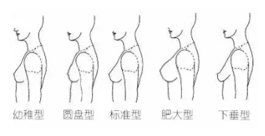 “世界上丰胸手术最多的形体医院”——凯丽国际