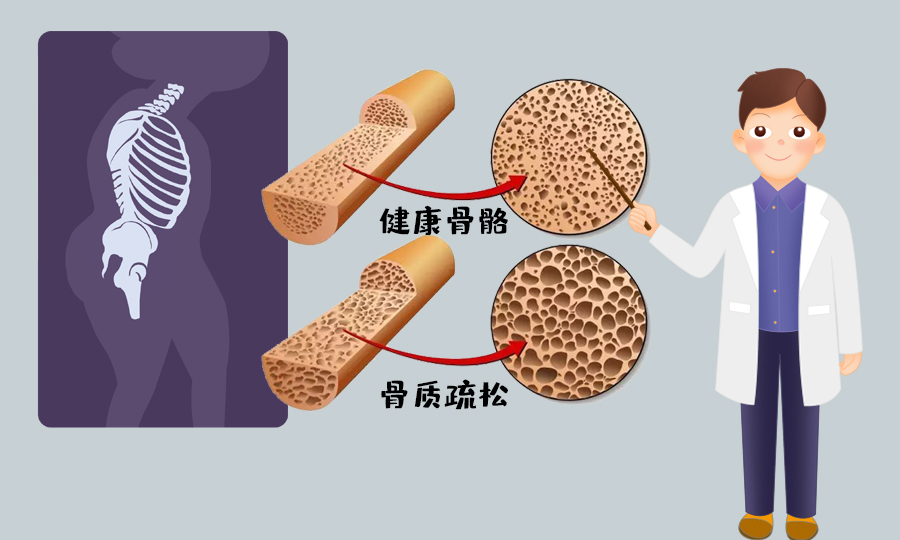 补肾抗衰系列谈—— 腰腿衰老并不是老年人的专利