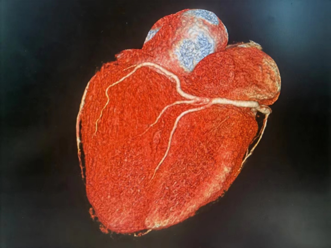 世界心脏病日|“人与血管同寿”，你知道么？